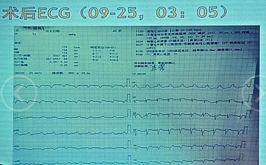 军犬麦克斯 视频缩略图