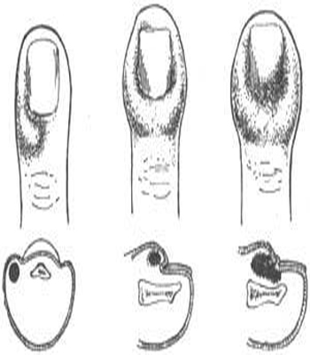 变身国王（粤语版） 视频海报